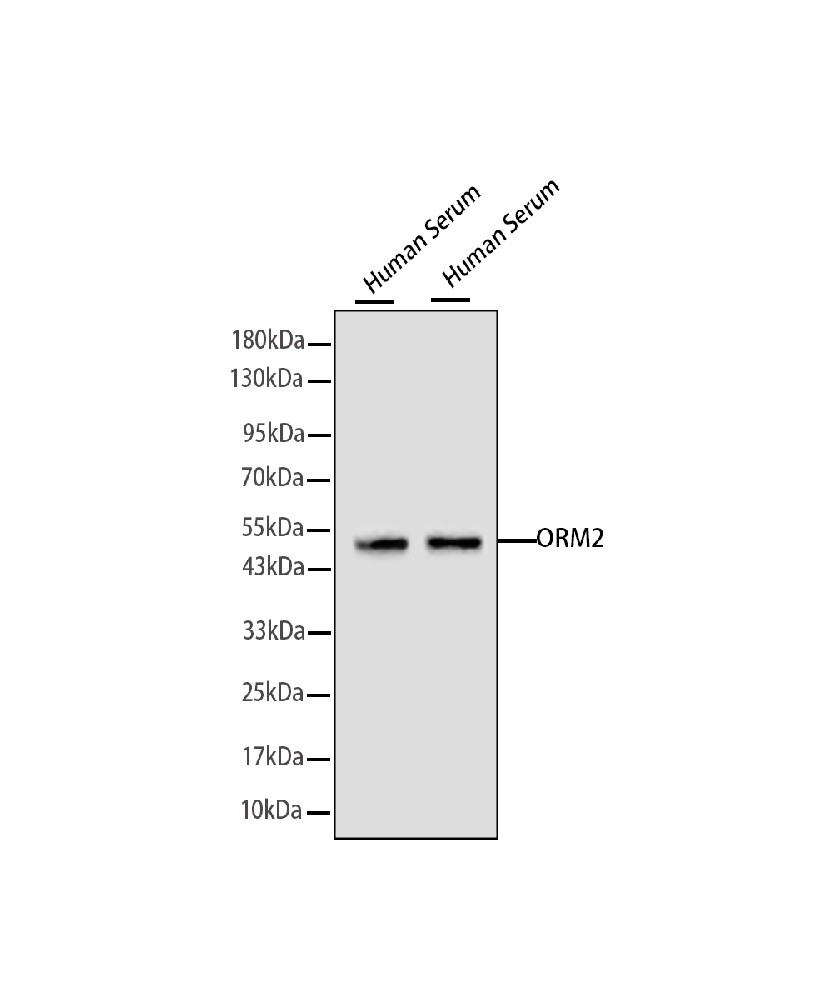 Orosomucoid 2 (ORM2) Mouse mAb