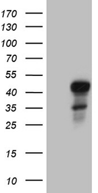 ELF3 (ELF3) Mouse mAb