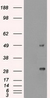 Anti-Ki67 Mouse mAb