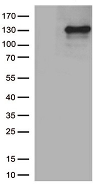 iNOS (NOS2) Mouse mAb