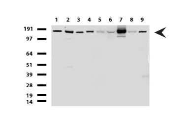 HER2 (ERBB2) Mouse mAb