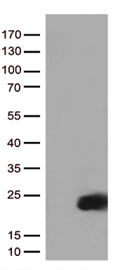 IL2 Mouse mAb
