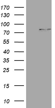 CPT1B Mouse mAb