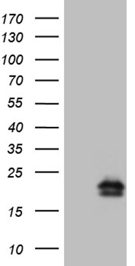 NPPA Mouse mAb