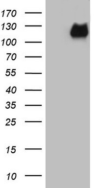 CSF2RB Mouse mAb