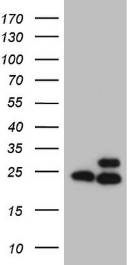 RPL10 Mouse mAb