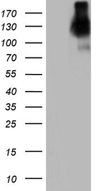 CEA (CEACAM5) Mouse mAb