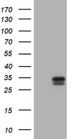 KLK2 Mouse mAb