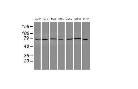 NUB1 (NYREN18) Mouse mAb