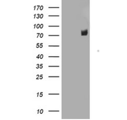 ENPEP Mouse mAb