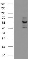 CYP17A1 Mouse mAb