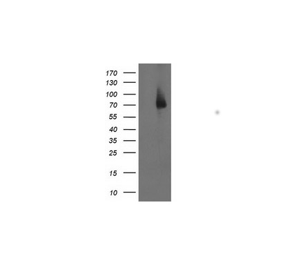 LIMK1 (LIM Kinase 1 ) Mouse mAb
