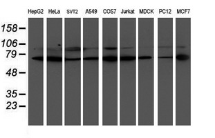 LIMK1 (LIM Kinase 1 ) Mouse mAb