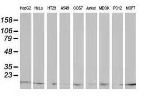 ATP6V1F Mouse mAb