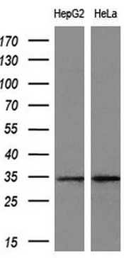 CTDSP1 Mouse mAb