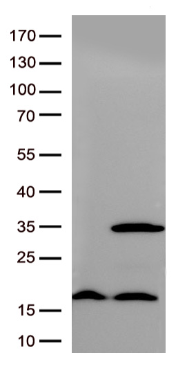 RIT2 Mouse mAb