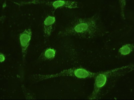 IL6 Mouse mAb