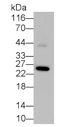Glutathione S Transferase Alpha 1 (GSTa1) Monoclonal Antibody