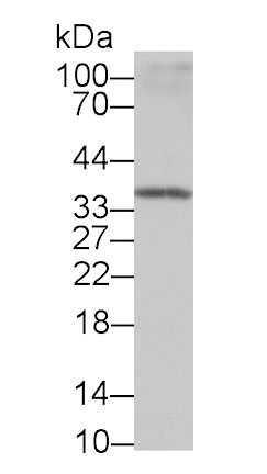 Carbonic Anhydrase IV (CA4) Monoclonal Antibody