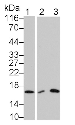 Interleukin 5 (IL5) Monoclonal Antibody