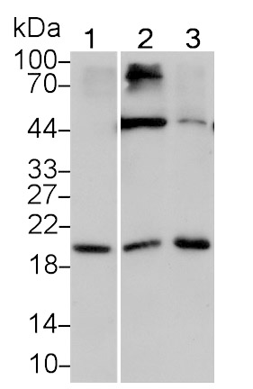 Interleukin 15 (IL15) Monoclonal Antibody