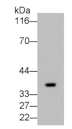 Fibrinogen Like Protein 1 (FGL1) Monoclonal Antibody