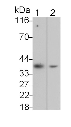 Interleukin 1 Beta (IL1b) Monoclonal Antibody