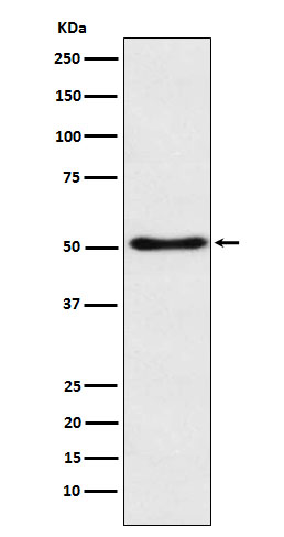 SFRP4 Rabbit mAb