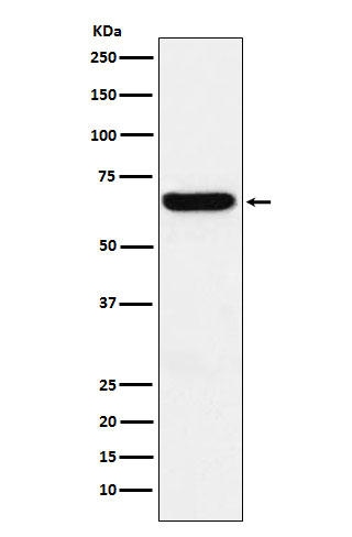 Methionine Aminopeptidase 2 Rabbit mAb