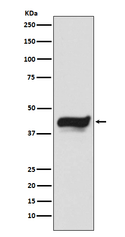 IKB epsilon  Rabbit mAb