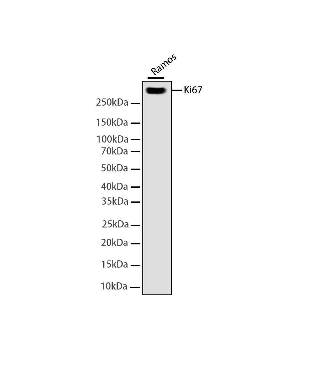 Ki67  Rabbit mAb