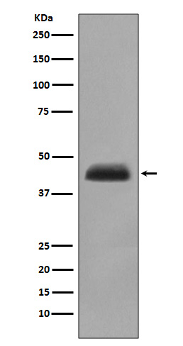 Cytokeratin 15  Rabbit mAb