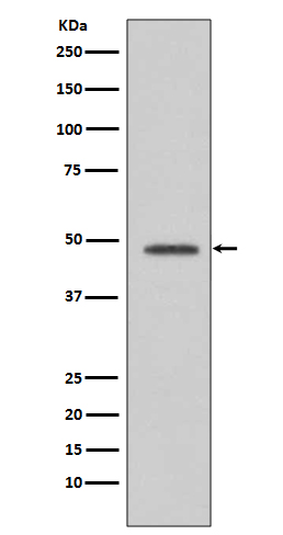 VASP  Rabbit mAb