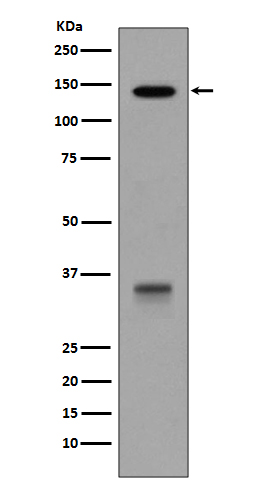 LDL Receptor  Rabbit mAb