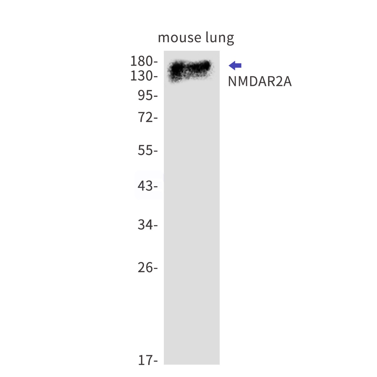 NMDAR2A Rabbit mAb