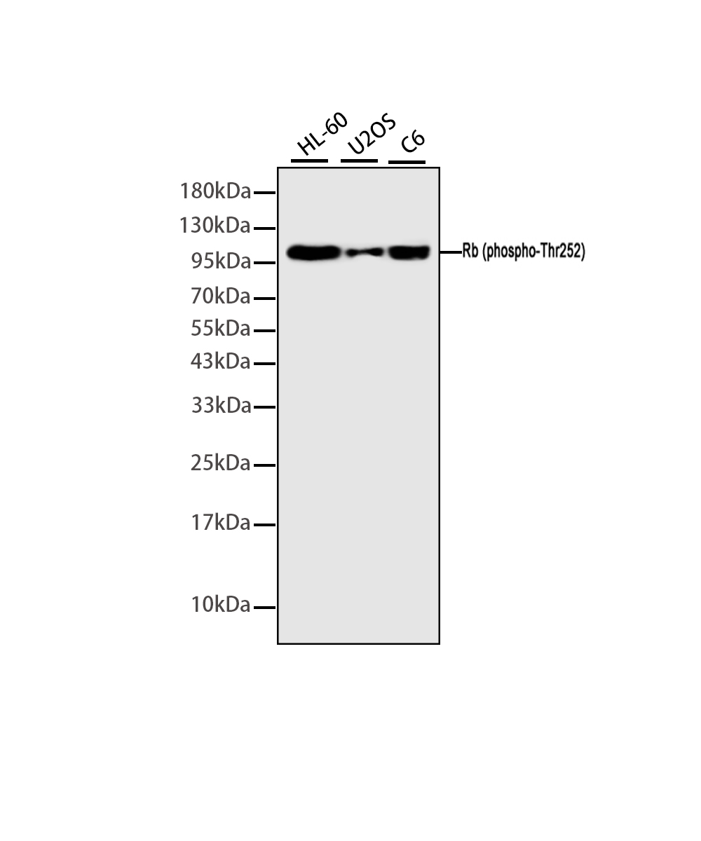 Phospho-Rb (Thr252) Rabbit mAb