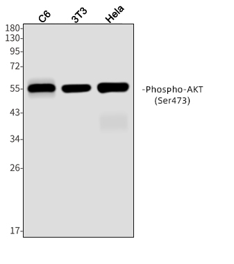 Phospho-AKT (Ser473) Rabbit mAb