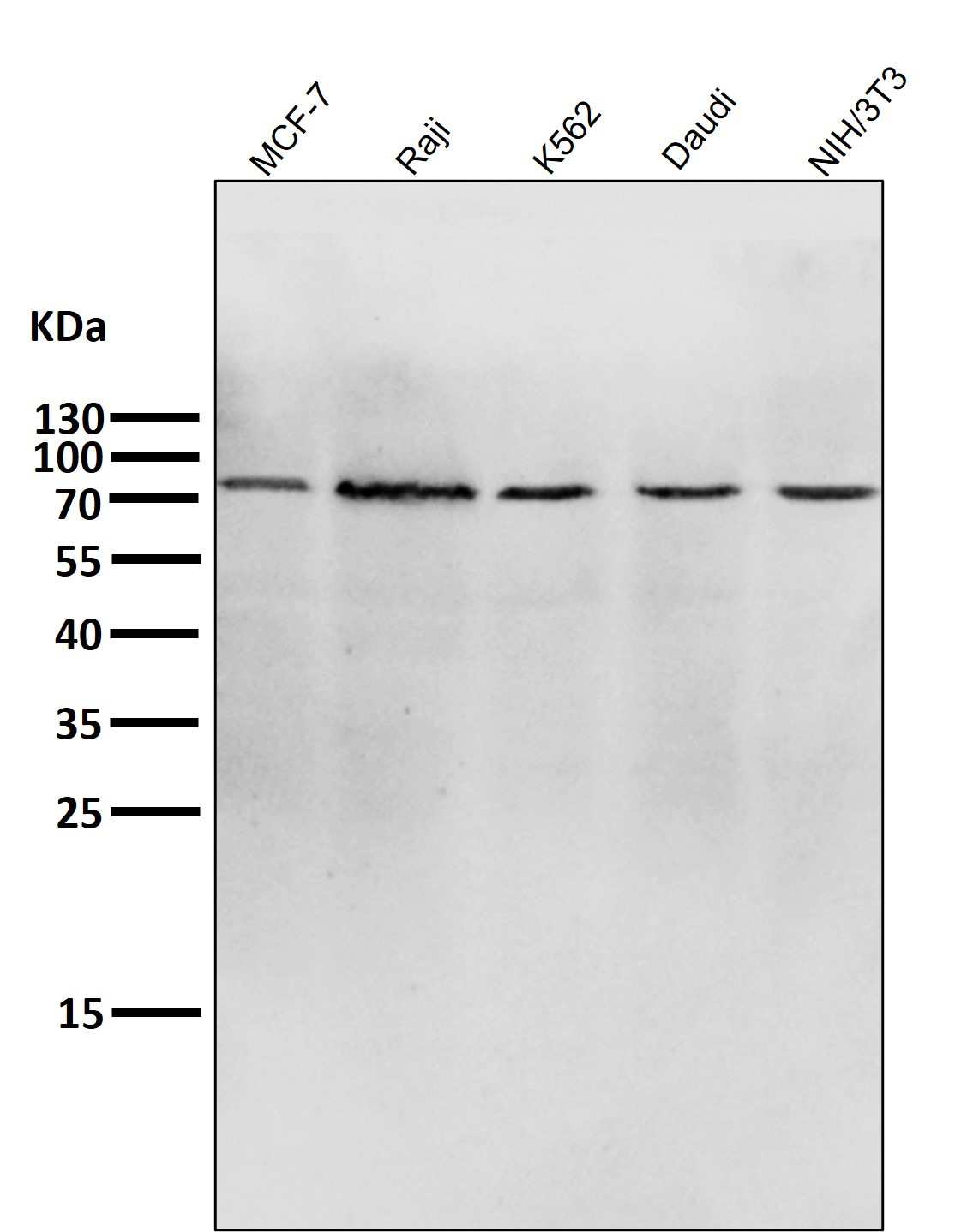 PI3 kinase p85 alpha Rabbit mAb