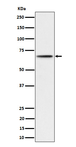 Phospho-P70 S6 Kinase beta (S371) Rabbit mAb