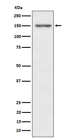 Phospho-Met (c-Met) (9V17) Rabbit mAb