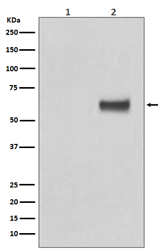 Phospho-ER alpha (S118) Rabbit mAb