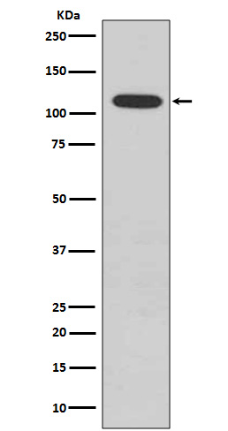 Phospho-Retinoblastoma (S807) Rabbit mAb