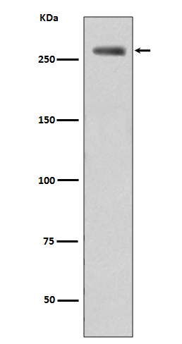 Phospho-LRRK2 (S935)  Rabbit mAb