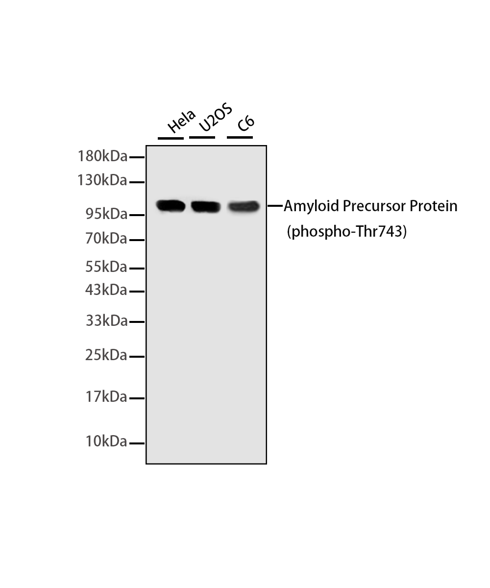 Phospho-Amyloid Precursor Protein (Thr743) Rabbit mAb