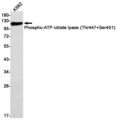 Phospho-ATP citrate lyase (Thr447/Ser451) Rabbit mAb