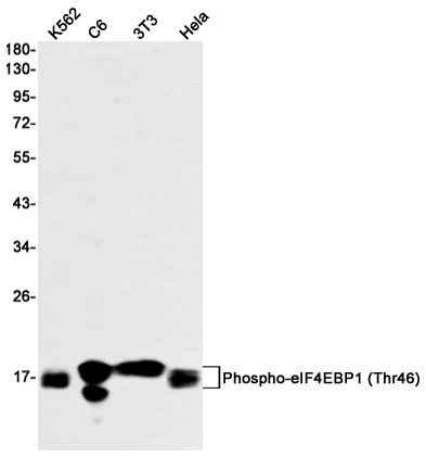 Phospho-eIF4EBP1/eIF4EBP2/eIF4EBP3 (Thr45) Rabbit mAb