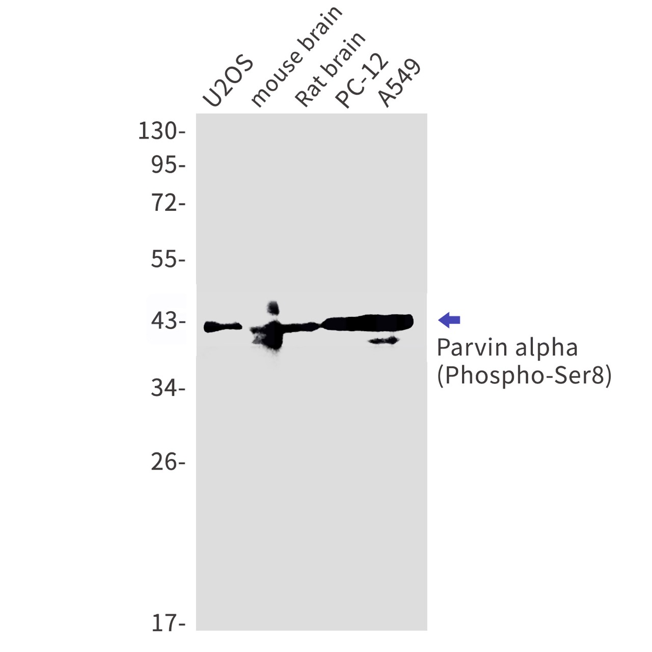Phospho-Parvin alpha (Ser8) Rabbit mAb