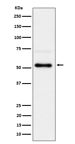 Phospho-Chk1 (S280) Rabbit mAb