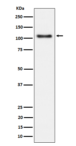 Phospho-Rb (S780) Rabbit mAb