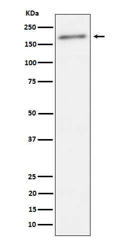 Phospho-ErbB2(Y1221 + Y1222) Rabbit mAb